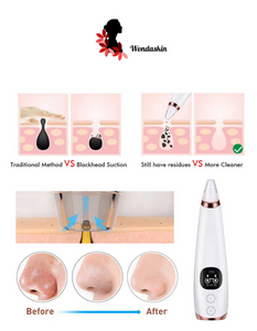 Wondaskin Blackhead Remover